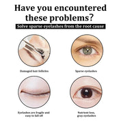 Fast Growth Eyelash & Eyebrow Serum – Natural Thick & Long Lashes