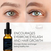 Fast Growth Eyelash & Eyebrow Serum – Natural Thick & Long Lashes